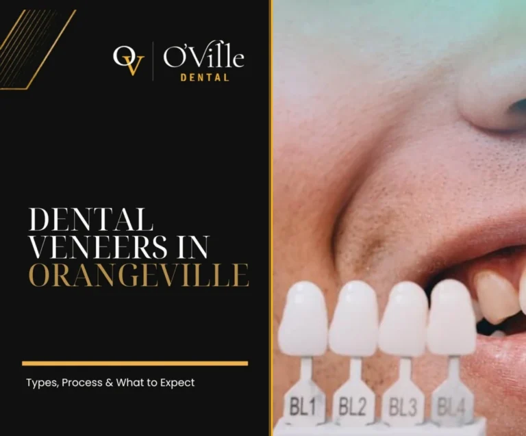 Dental veneer shade guide held beside a smiling patient at O’Ville Dental in Orangeville