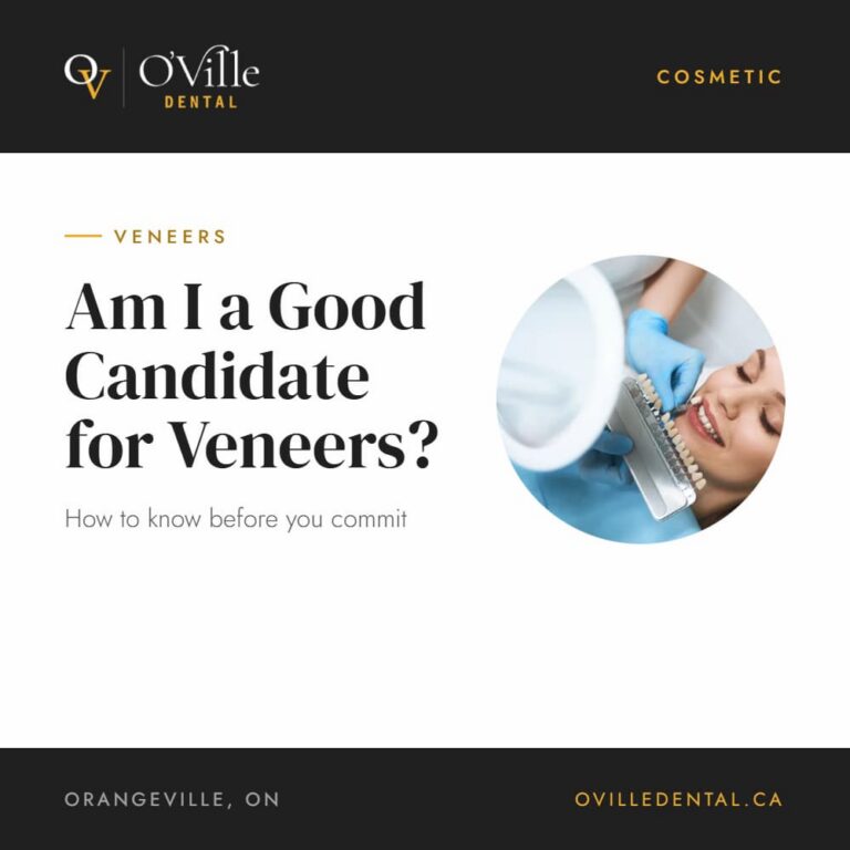 How Do I Know If I'm a Good Candidate for Veneers?