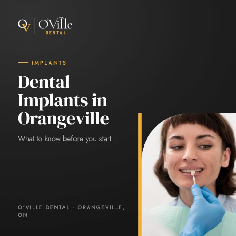 Dental Implants in Orangeville: What to Know Before You Start