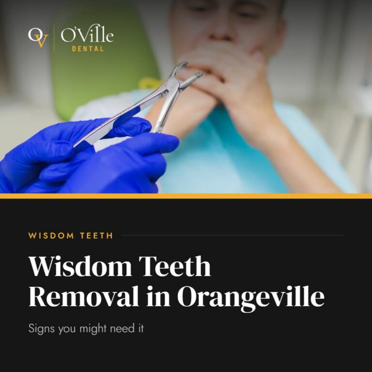 Wisdom Teeth Removal in Orangeville: Signs You Might Need It