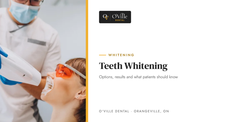 Teeth Whitening: Options, Results and What Patients Should Know