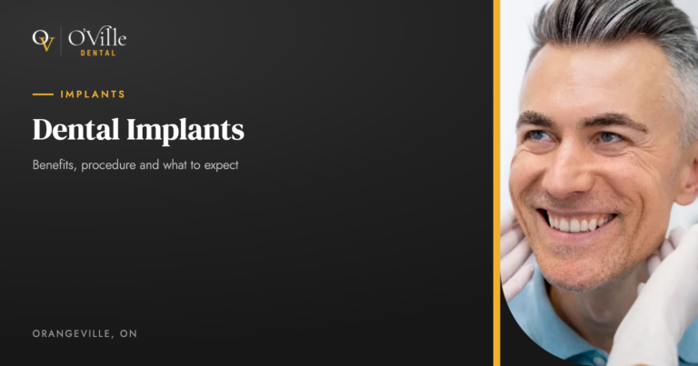 Dental Implants: Benefits, Procedure and What to Expect